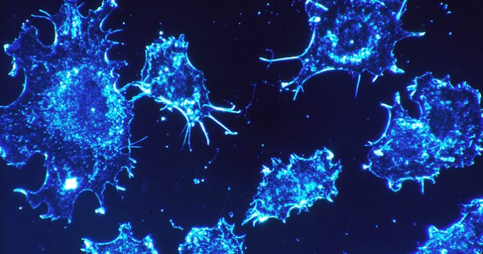 Cancer Slowly Dies When You Start Eating These 7 Foods