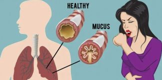 How To Get Rid Of Phlegm And Mucus In Chest And Throat
