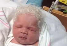 When The Baby Is Born With Snow-White Hair, The Parents Are Unsure Of What To Do