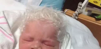 When The Baby Is Born With Snow-White Hair, The Parents Are Unsure Of What To Do