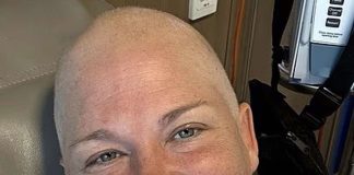 Stage 4 cancer patient warns overlooked minor signs can mask a fatal disease