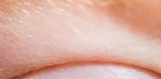 Wake-Up Mystery: People Stunned to Learn What the Yellow Substance in Your Eyes Actually Is