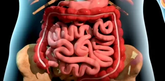 A Visual Education: Striking Simulation Illustrates the Step-by-Step Progression of Death from Cancer