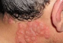 Why many experts advise against sleeping with window open