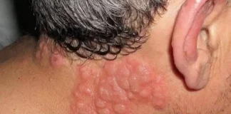 Why many experts advise against sleeping with window open