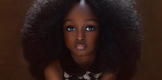 When She Was 5 She Had โThe Most Beautiful Face In The Worldโ But Wait Till You See Her Today