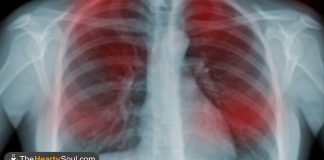 20 Early Warning Signs of Cancer and How to Reduce Your Cancer Risk