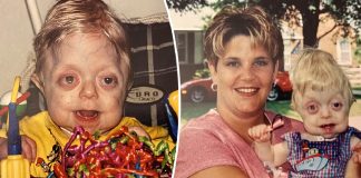 Teen not expected to live past 18 months graduates high school