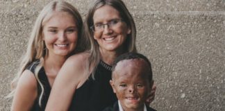 Foster baby is adopted 7 years after apartment fire left him with horrific burns