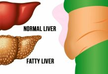 6 warning signs that your liver is full of toxins