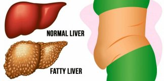 6 warning signs that your liver is full of toxins
