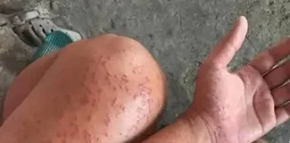 I spent a couple of nights at my friend’s previous apartment and saw these unusual bumps