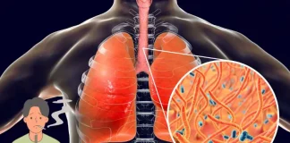 Get Rid of Phlegm and Mucus in Chest and Throat