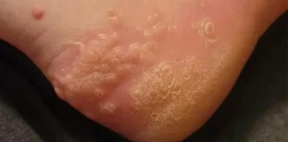 These are the consequences of wearing used…