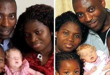 Black couple gives birth to blonde, blue-eyed child who they call “a miracle baby”