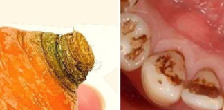 Natural Teeth Whitening with Carrot Tops