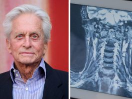 Expert reveals why HPV-related throat cancer is rising among men