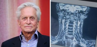 Expert reveals why HPV-related throat cancer is rising among men