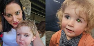 Toddler’s eye ”melts away” after wrong person kissed him