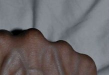 The Real Reason Your Veins Are Becoming More Visible (When It’s Normal and When It’s a Health Warning)