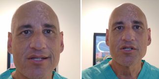 Heart surgeon warns everyone about this food that ‘destroys your heart’ daily –