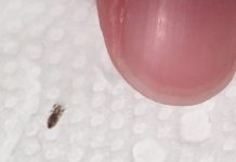 Head lice: How to get rid of them and stop them coming back